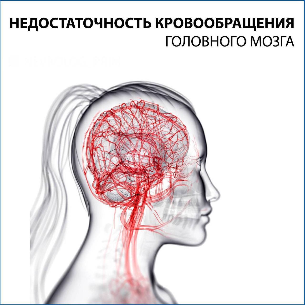 Лечение мозговой недостаточности. Капельницы при инсульте головного мозга. Боль в голове из за стресса. Болезни связанные с головой.