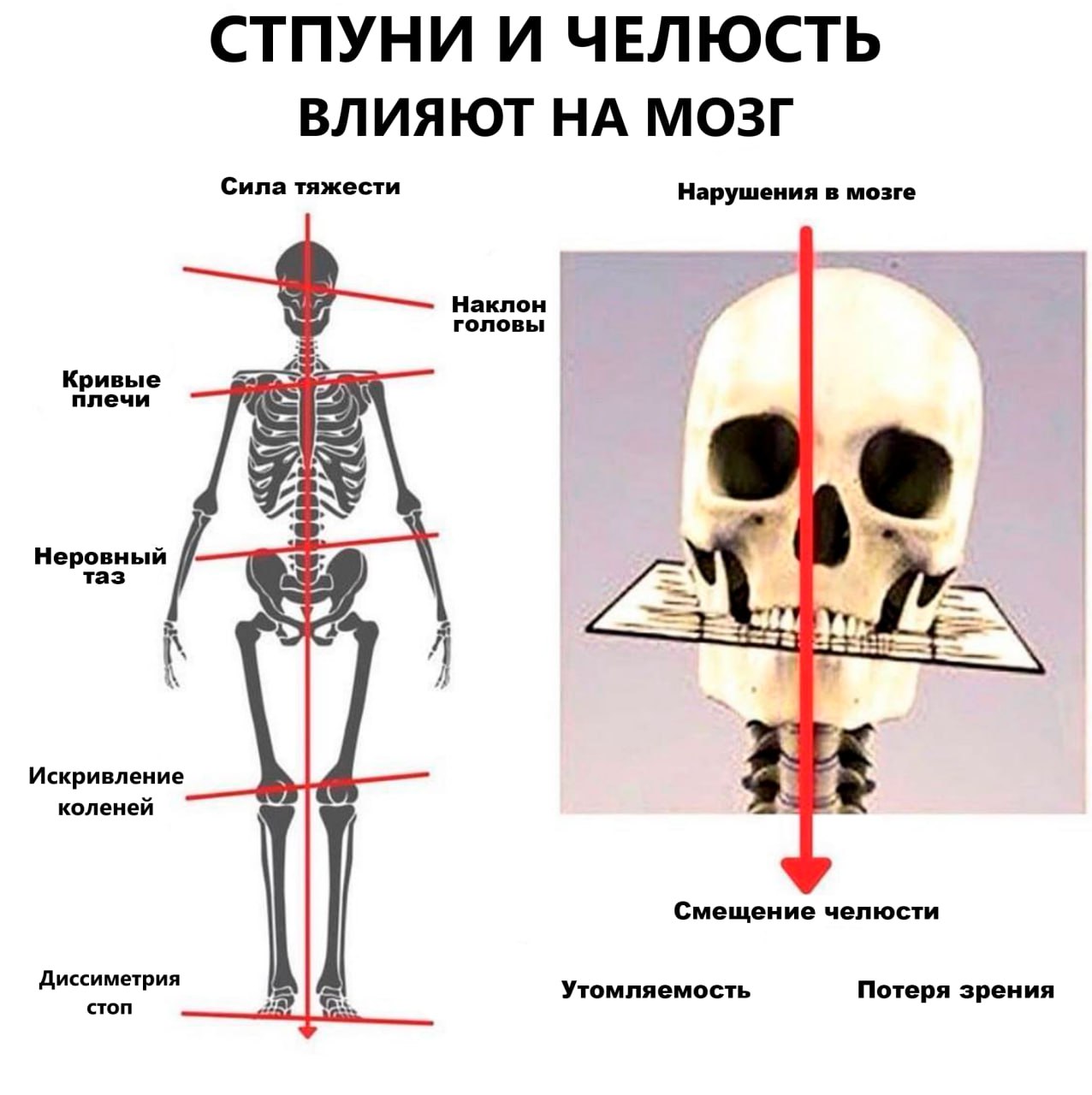 Изменение формы черепа у взрослого