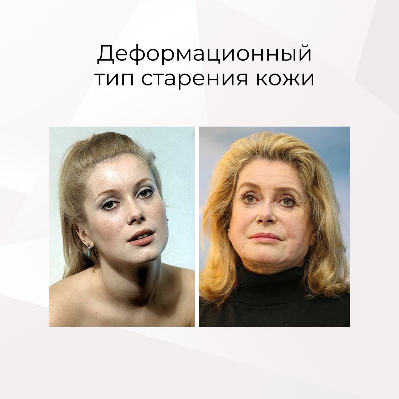 Какой морфотип изображен на фотографиях Какой морфотип изображен на фотографиях
