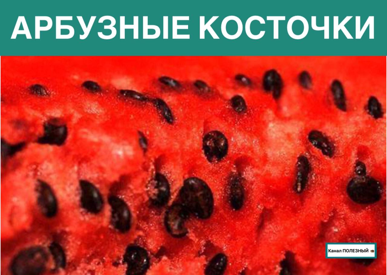 Косточки арбуза польза. Косточки арбуза польза. Семечко арбуза. Арбуз с крупными косточками сорт. Арбузная косточка полезные.